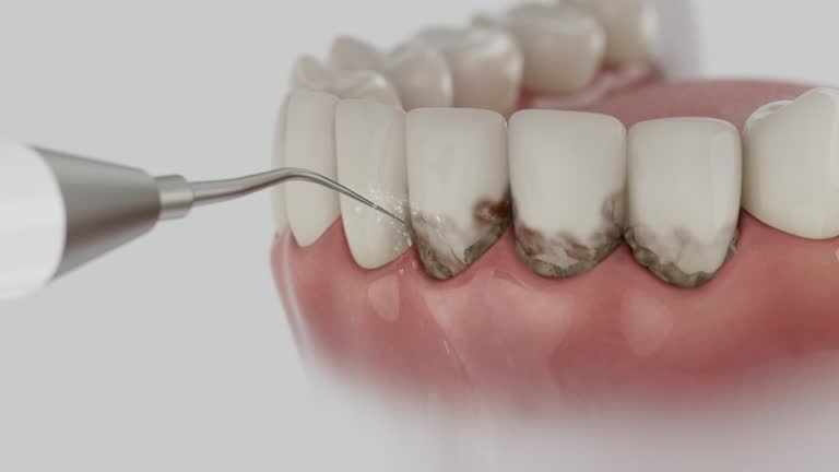 Reliable Dental contractor in Redkey, IN by Dentist Open Now